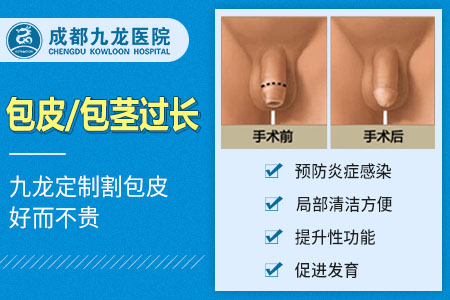 四川省的男科医院能做包茎手术吗